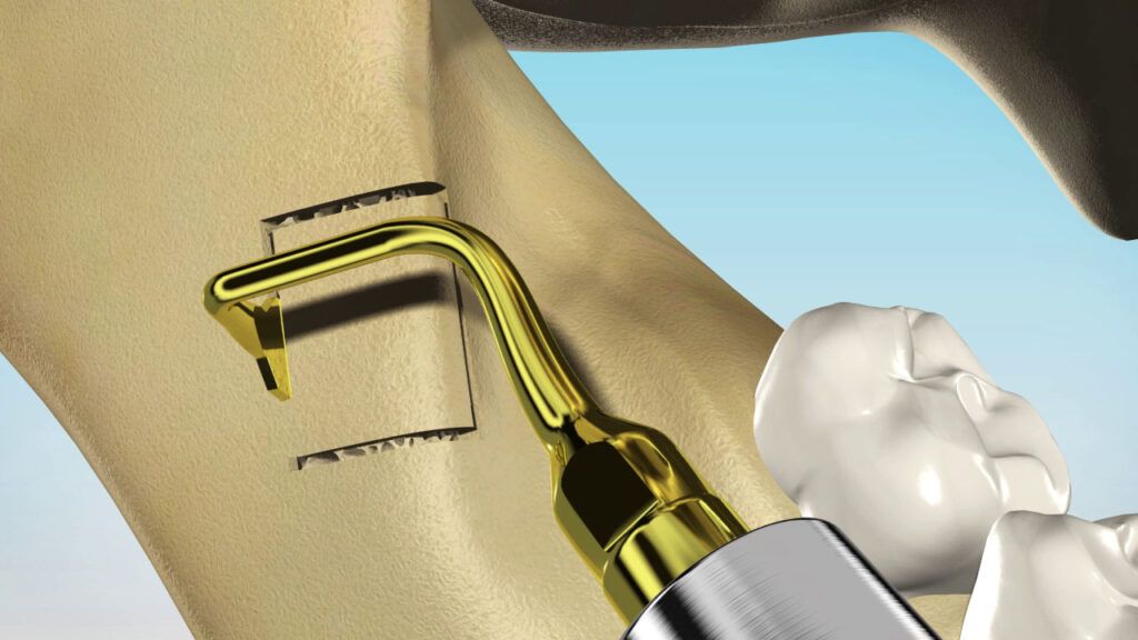 3D-Animation für zahnmedizinische Schulungen